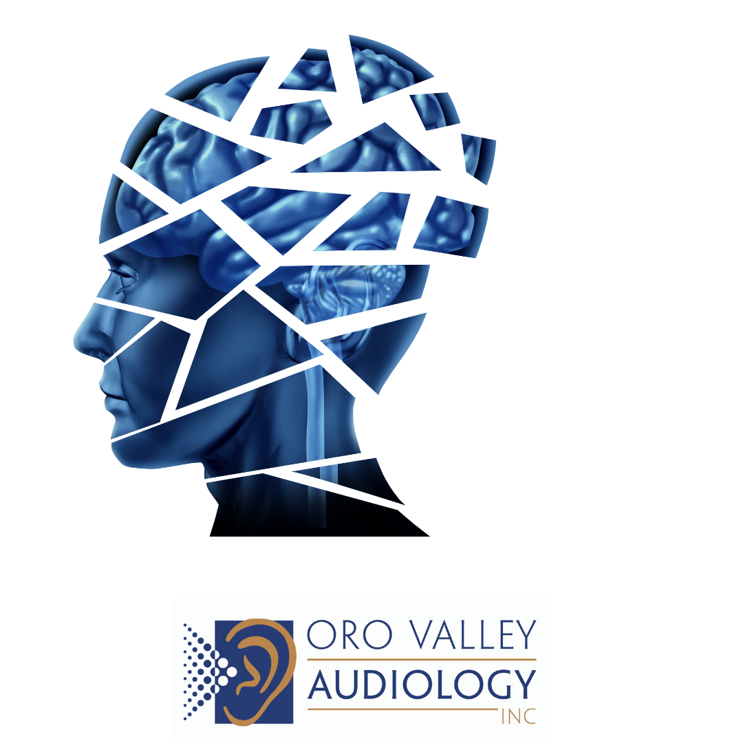 The Audiologist’s Role in Brain Health